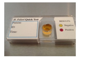 this CLO test kit contains phenol red - it is yellow when acid and red when alkaline