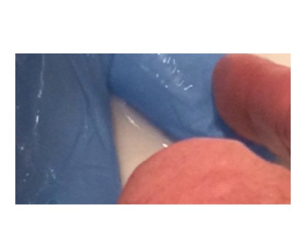 even with reduced volume - when lying flat the thumb is still filled with water and blood pressure is maintained