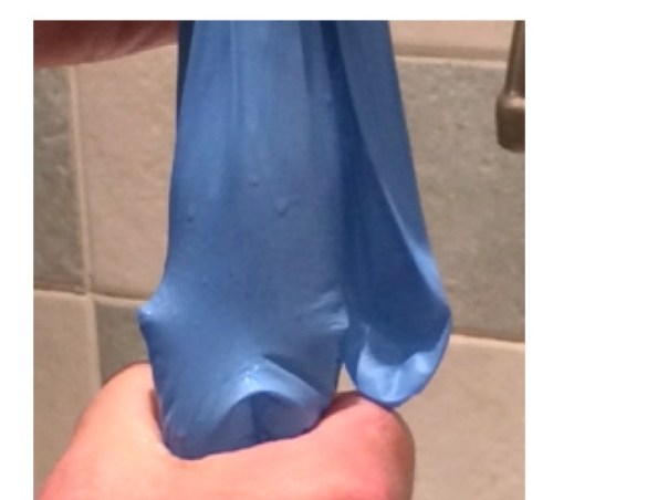 with reduced volume, squeezing the legs and abdomen no longer maintains filling of the thumb - cardiac filling reduces and blood pressure drops