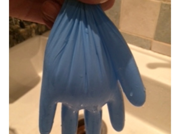 overfilling the glove means that even with no squeeze to the veins the thumb remains full of water when the glove is upright - overfilling the circulation with fludrocortisone can help prevent postural hypotension