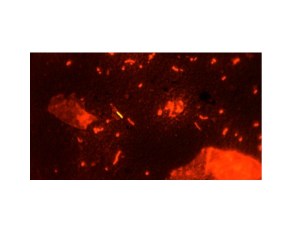 Image from Centers for Disease Control and Prevention